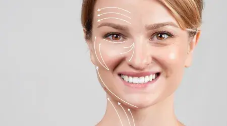botox